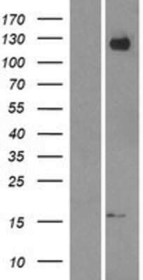 Western Blot: APP Overexpression Lysate [NBP2-09023]