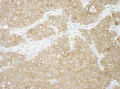 Immunohistochemistry: Ancient ubiquitous protein 1 Antibody [NBP1-49916]