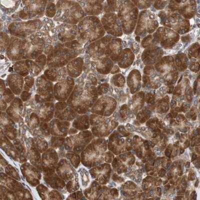 Immunohistochemistry-Paraffin: Ancient ubiquitous protein 1 Antibody [NBP1-85785]