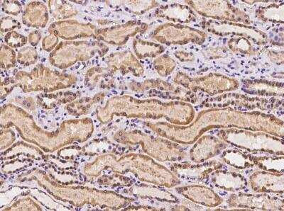 Immunohistochemistry-Paraffin: Ancient ubiquitous protein 1 Antibody [NBP3-06403]