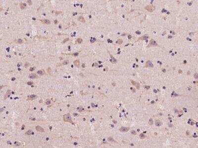 Immunohistochemistry-Paraffin: Ancient ubiquitous protein 1 Antibody [NBP3-06403]