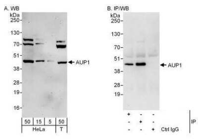 Western Blot: Ancient ubiquitous protein 1 Antibody [NBP1-49916]