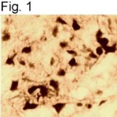 Immunohistochemistry: Androgen R/NR3C4 Antibody (AN1-15) - BSA Free [NB300-615]