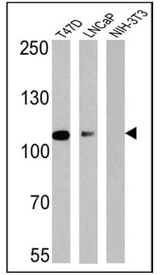 Western Blot: Androgen R/NR3C4 Antibody (AN1-15)BSA Free [NB300-615]