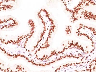 Immunohistochemistry-Paraffin: Androgen R/NR3C4 Antibody (AR441 + DHTR/882) [NBP2-44789]