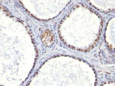 Immunohistochemistry-Paraffin: Androgen R/NR3C4 Antibody (AR441) - Azide and BSA Free [NBP2-47854]