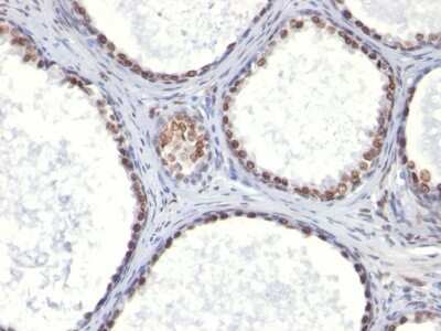 Immunohistochemistry-Paraffin: Androgen R/NR3C4 Antibody (AR441) - IHC-Prediluted [NBP2-48159]