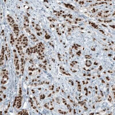 Immunohistochemistry-Paraffin: Androgen R/NR3C4 Antibody (CL9255) [NBP2-88922]