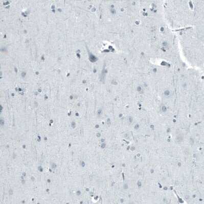 Immunohistochemistry-Paraffin: Androgen R/NR3C4 Antibody (CL9255) [NBP2-88922]
