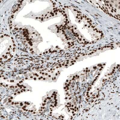 Immunohistochemistry-Paraffin: Androgen R/NR3C4 Antibody (CL9255) [NBP2-88922]