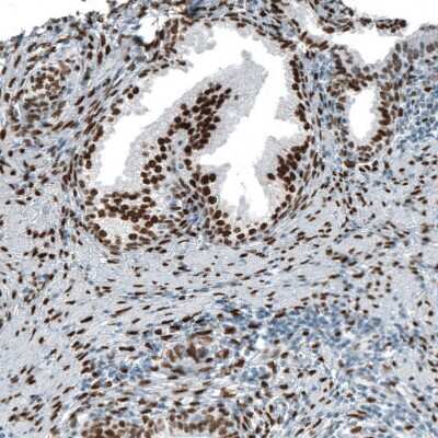 Immunohistochemistry-Paraffin: Androgen R/NR3C4 Antibody (CL9255) [NBP2-88922]