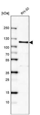 Western Blot: Androgen R/NR3C4 Antibody (CL9255) [NBP2-88922]