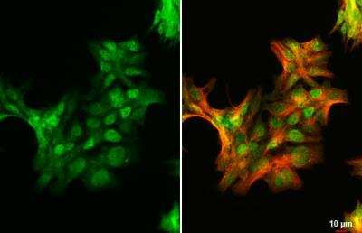 Immunocytochemistry/ Immunofluorescence: Androgen R/NR3C4 Antibody (HL1028) - ARv7 Variant [NBP3-13685]