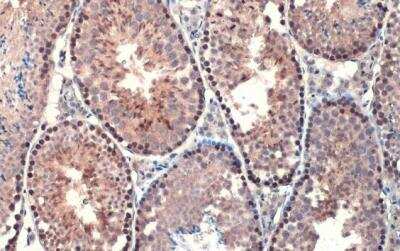 Immunohistochemistry-Paraffin: Androgen R/NR3C4 Antibody (HL1028) - ARv7 Variant [NBP3-13685]