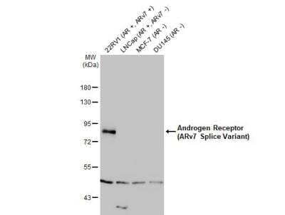 Western Blot: Androgen R/NR3C4 Antibody (HL1028)ARv7 Variant [NBP3-13685]