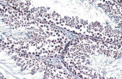 Immunohistochemistry-Paraffin: Androgen R/NR3C4 Antibody [NBP2-15384]