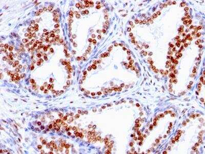 Immunohistochemistry-Paraffin: Androgen R/NR3C4 Antibody (SPM335) - Azide and BSA Free [NBP2-47855]