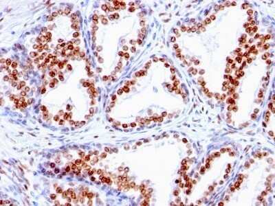 Immunohistochemistry-Paraffin: Androgen R/NR3C4 Antibody (SPM335) - IHC-Prediluted [NBP2-48160]