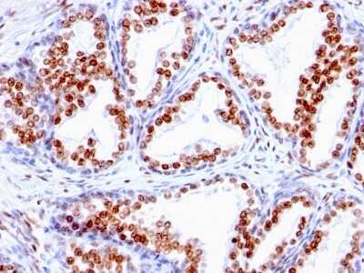 Immunohistochemistry-Paraffin: Androgen R/NR3C4 Antibody (SPM335) [NBP2-44787]