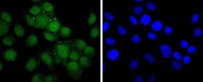 Immunocytochemistry/ Immunofluorescence: Androgen R/NR3C4 Antibody (ST0453) [NBP2-67497]