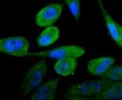 Immunocytochemistry/ Immunofluorescence: Androgen R/NR3C4 Antibody (ST0453) [NBP2-67497]