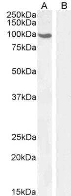 Western Blot: Androgen R/NR3C4 Antibody [NB100-1446]