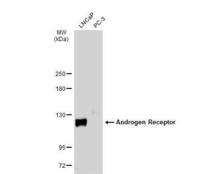 Western Blot: Androgen R/NR3C4 Antibody [NBP2-15384]