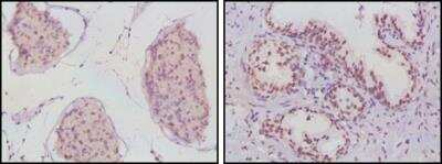 Immunohistochemistry-Paraffin: Androgen R/NR3C4 Antibody (2H8) - BSA Free [NBP1-47471]