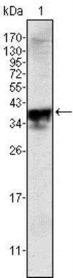 Western Blot: Androgen R/NR3C4 Antibody (2H8)BSA Free [NBP1-47471]