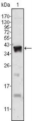 Western Blot: Androgen R/NR3C4 Antibody (2H8)BSA Free [NBP1-47471]
