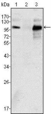 Western Blot: Androgen R/NR3C4 Antibody (2H8)BSA Free [NBP1-47471]