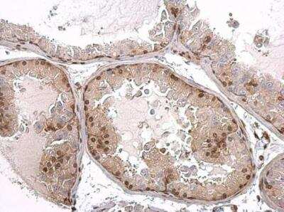 Immunohistochemistry-Paraffin: Androgen R/NR3C4 Antibody [NBP2-15384]
