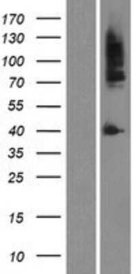 Western Blot: Androgen R/NR3C4 Overexpression Lysate [NBP2-04146]