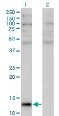 Western Blot: Angiogenin Antibody (2A7) [H00000283-M05]