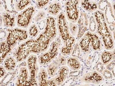 Immunohistochemistry-Paraffin: Angiogenin Antibody [NBP2-98773]