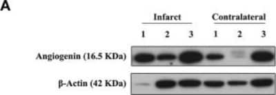 Western Blot: Angiogenin AntibodyBSA Free [NBP2-41185]