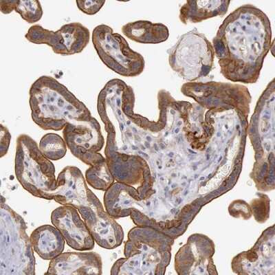 Immunohistochemistry-Paraffin: Angiomotin like 1 Antibody [NBP1-91665]