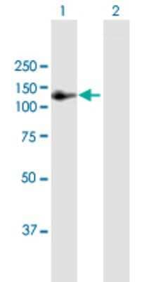 Western Blot: Angiomotin like 1 Antibody [H00154810-B01P]