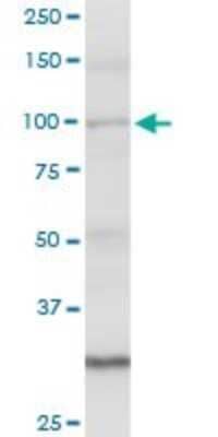 Western Blot: Angiomotin like 1 Antibody [H00154810-D01P]