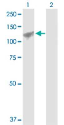 Western Blot: Angiomotin like 1 Antibody [H00154810-D01P]
