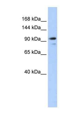 Western Blot: Angiomotin like 1 Antibody [NBP1-55099]