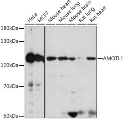 Western Blot: Angiomotin like 1 AntibodyAzide and BSA Free [NBP2-92393]