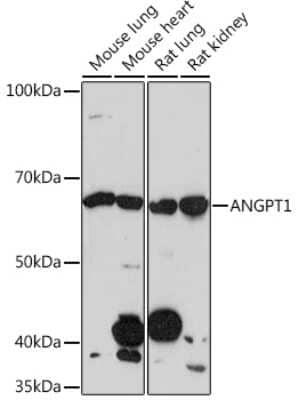 Western Blot: Angiopoietin-1 Antibody (6C4S7) [NBP3-16269]