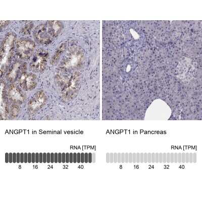 Immunohistochemistry-Paraffin: Angiopoietin-1 Antibody [NBP1-90170]