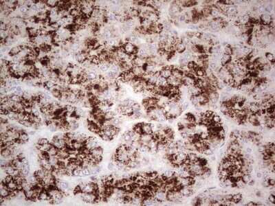 Immunohistochemistry: Angiopoietin-1 Antibody (OTI8H2) - Azide and BSA Free [NBP2-70172]