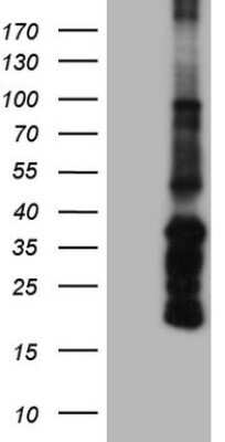 Western Blot: Angiopoietin-1 Antibody (OTI8H2)Azide and BSA Free [NBP2-70172]