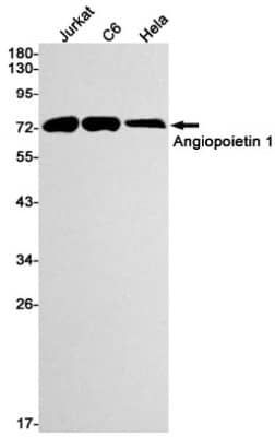 Western Blot: Angiopoietin-1 Antibody (S06-1F9) [NBP3-19492]