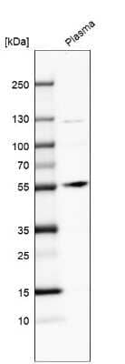 Western Blot: Angiopoietin-1 Antibody [NBP1-90169]