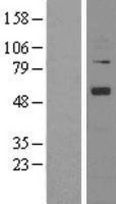 Western Blot: Angiopoietin-1 Overexpression Lysate [NBL1-07521]