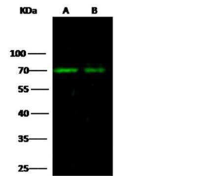 Western Blot: Angiopoietin-2 Antibody (117) [NBP2-89600]